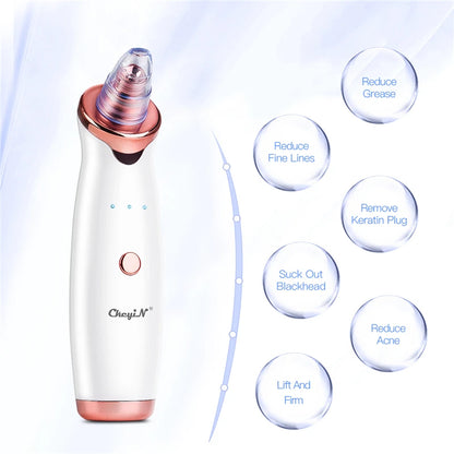 CkeyiN Electric Blackhead Remover Vacuum Facial Acne Cleaner Pimple Pore Cleansing Device Black Nose Point Beauty Skin Care Tool